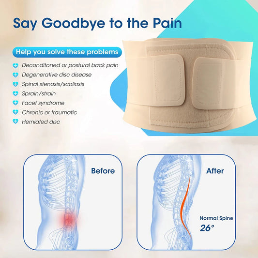 Adjustable Thin Breathable Back Brace for Men and Women, Waist Trainer Belt, Spine Support, Lumbar Corset, Gym Belts, 1Pc